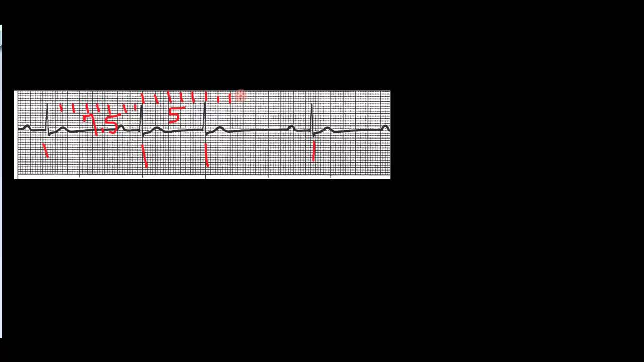 The six second method