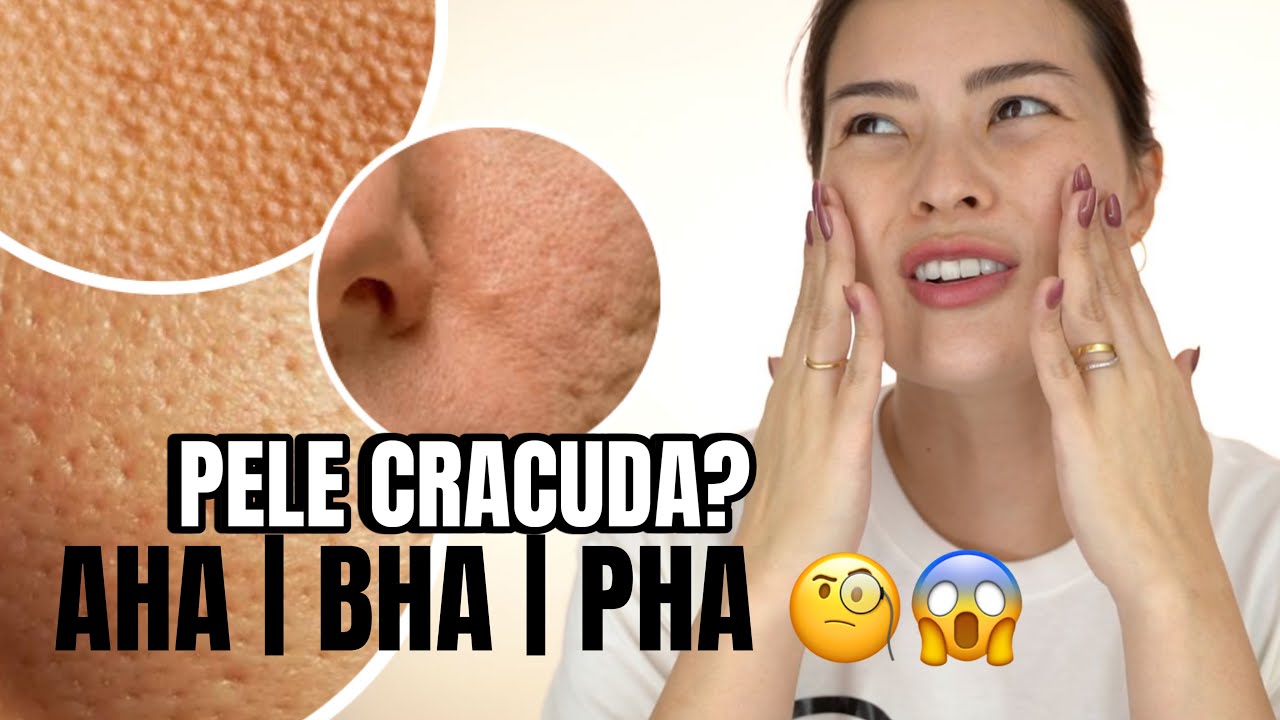 COMO ESCOLHER O ÁCIDO ESFOLIANTE CERTO PARA SUA PELE? 🎊✨
