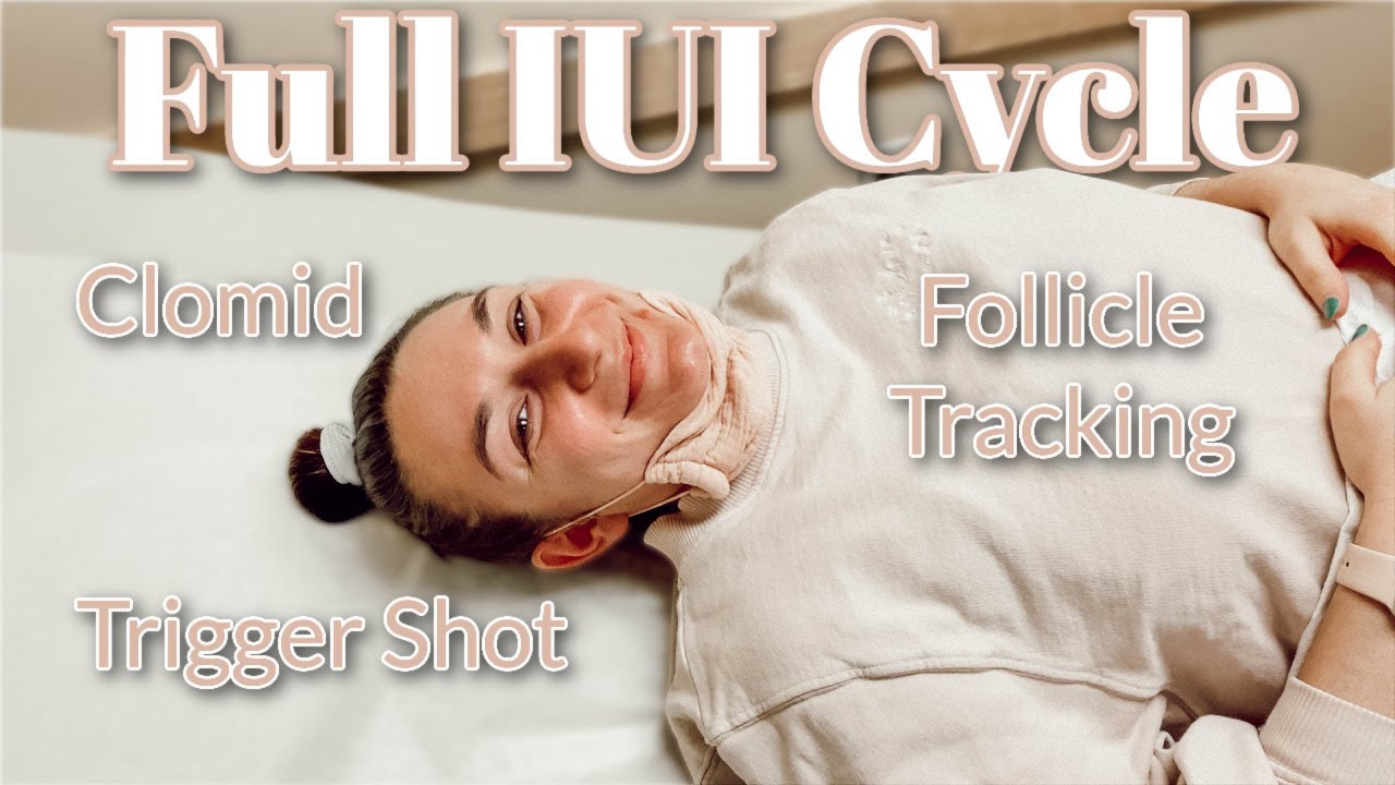 A FULL IUI CYCLE | Clomid, Follicle Monitoring, Trigger Shot, IUI Procedure | 2 Years of Infertility