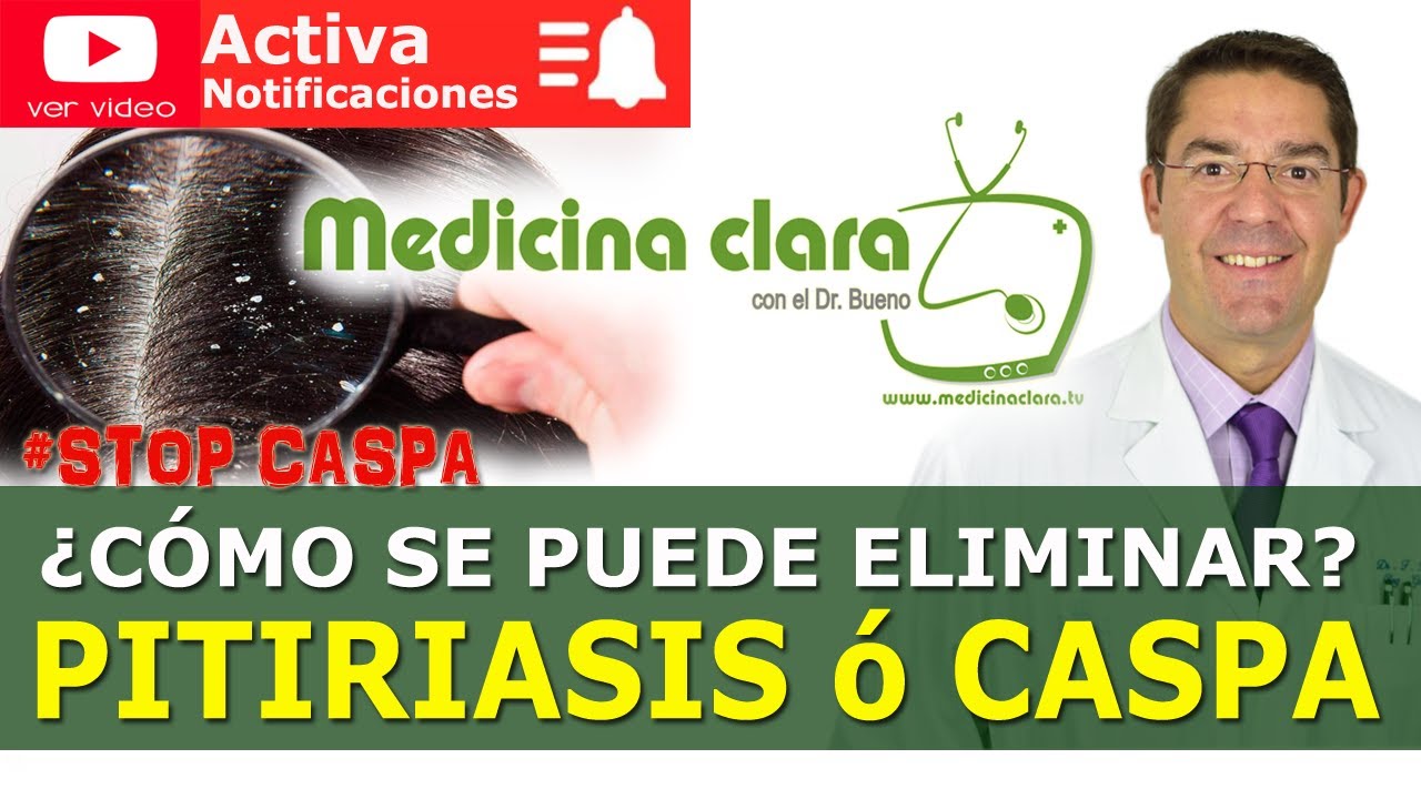 Caspa, claves para eliminar la caspa de forma efectiva. Relación caspa y calvicie | Medicina Clara