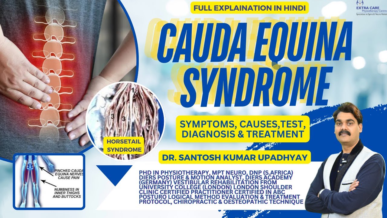 Cauda Equina Syndrome | Causes, Symptoms, Test & Treatment | Physiotherapy for CES | 9455555207