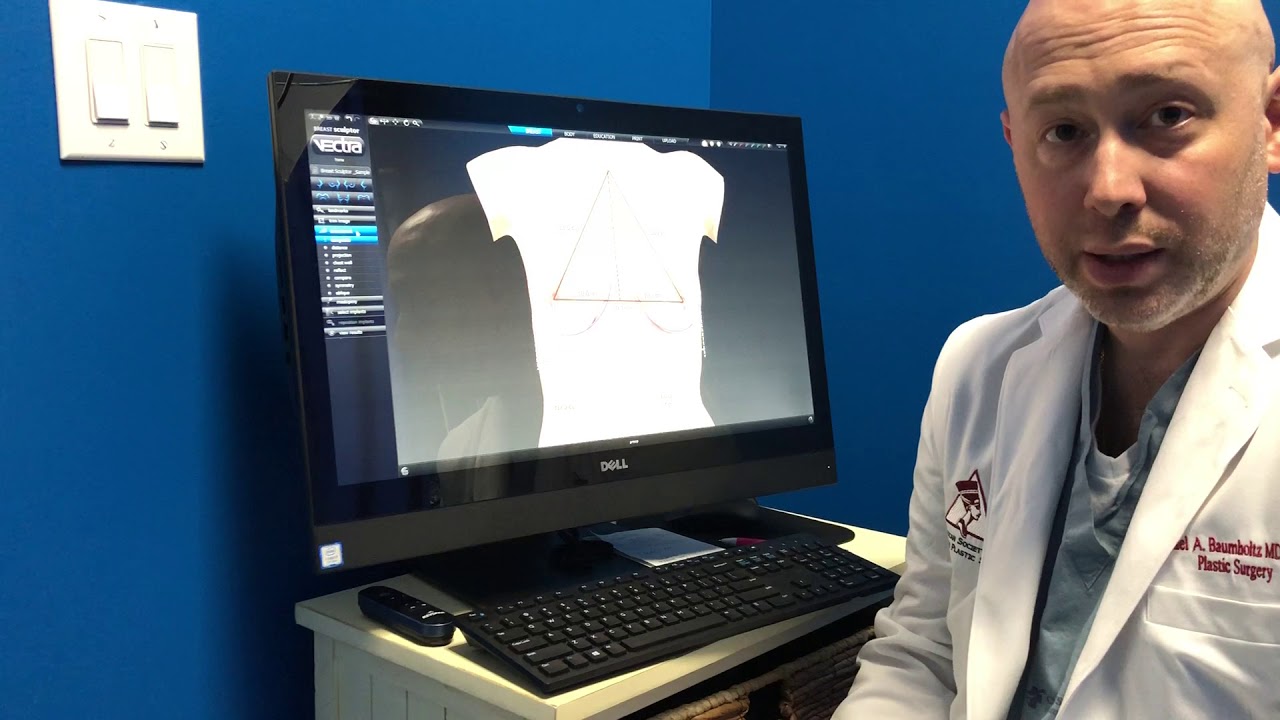 VECTRA 3D Imaging for Breast Surgery (Breast Augmentation)  | Plastic Surgeon San Antonio, Texas