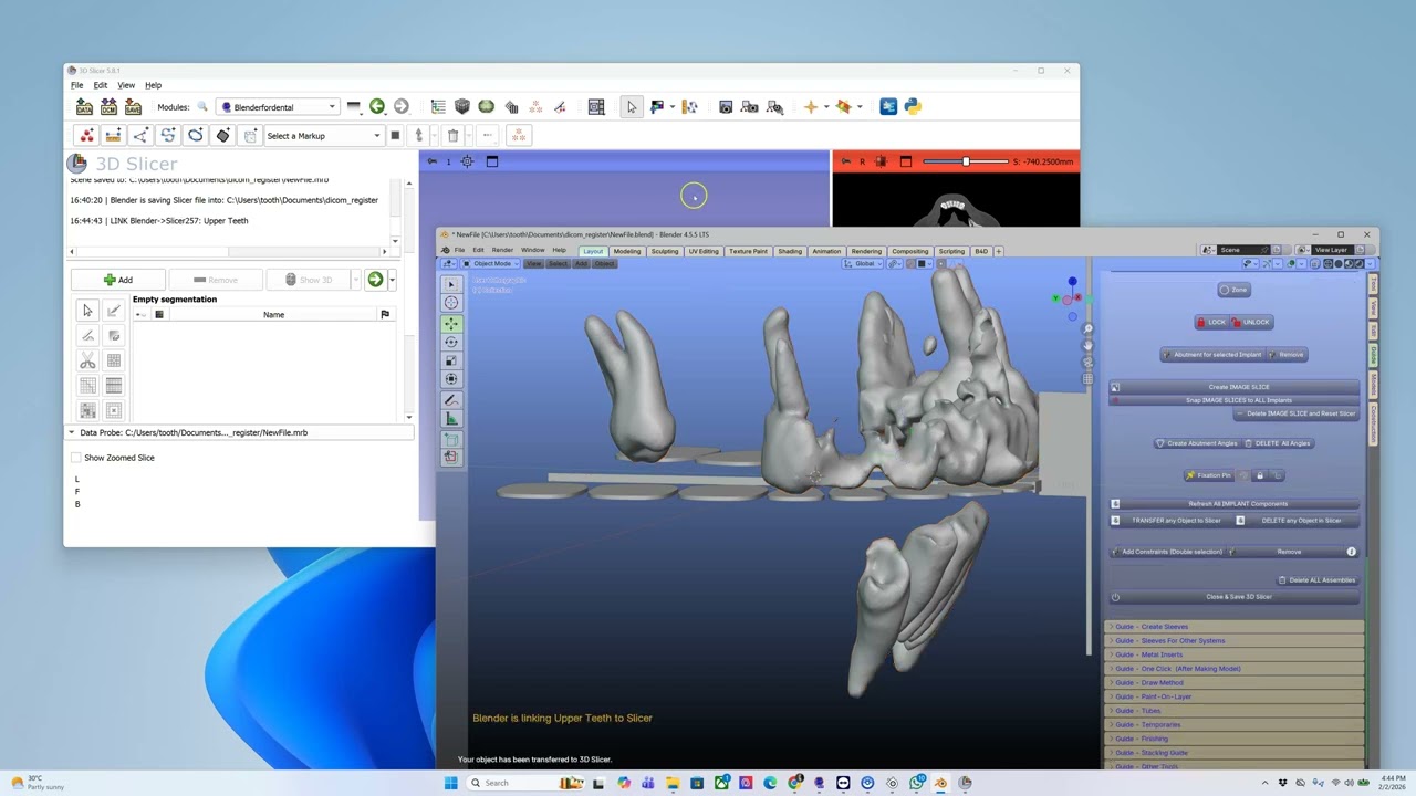The dicom and models are in the wrong location in Blender.