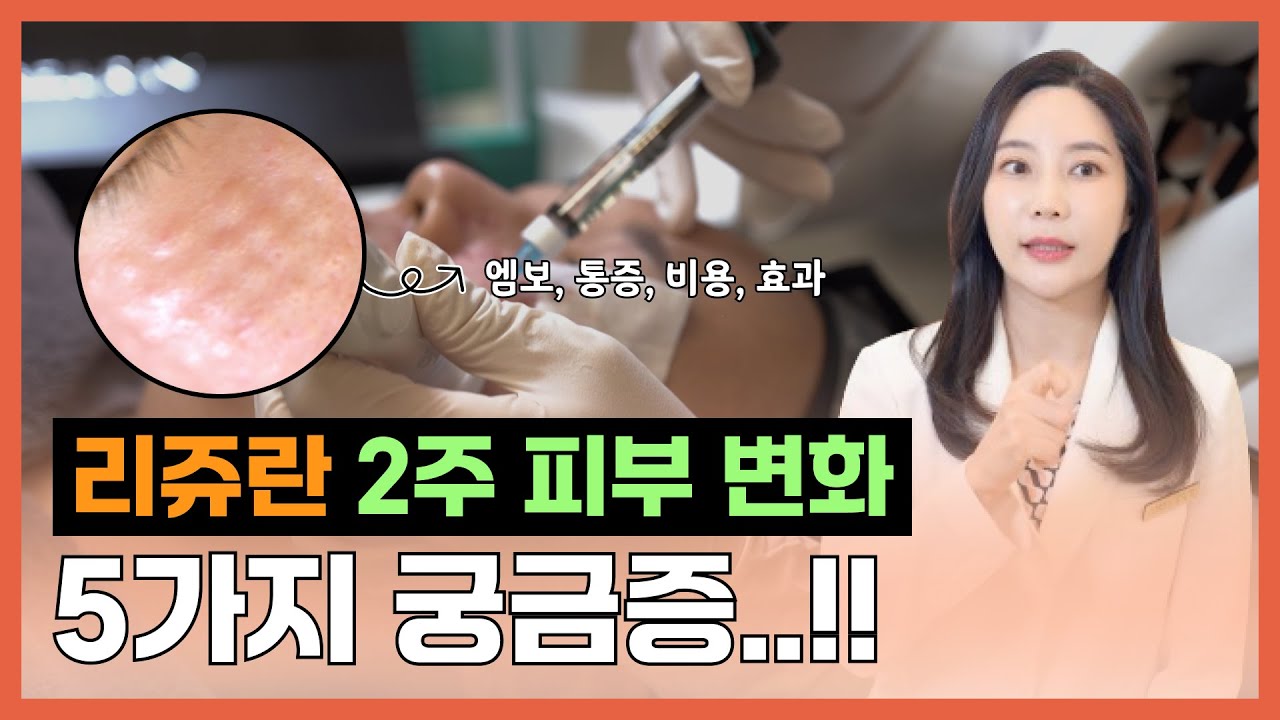 얼마나 좋길래? 직접해본 리쥬란힐러 2주 피부 변화 과정 (엠보, 통증, 비용 등 총정리편)