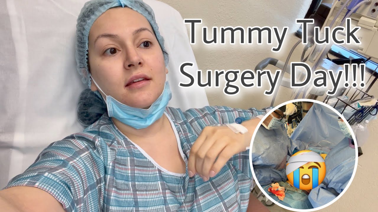 Tummy Tuck Surgery Day!!! *** PAINFUL***
