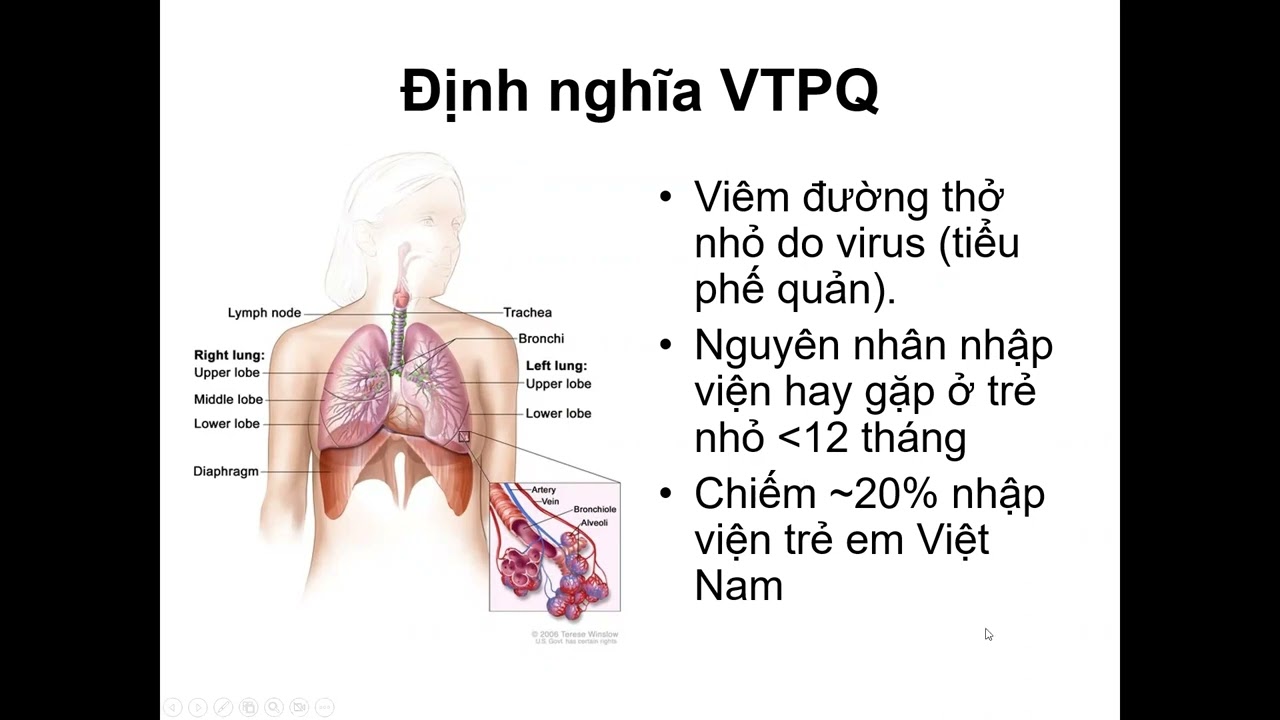 Viêm phổi trẻ em