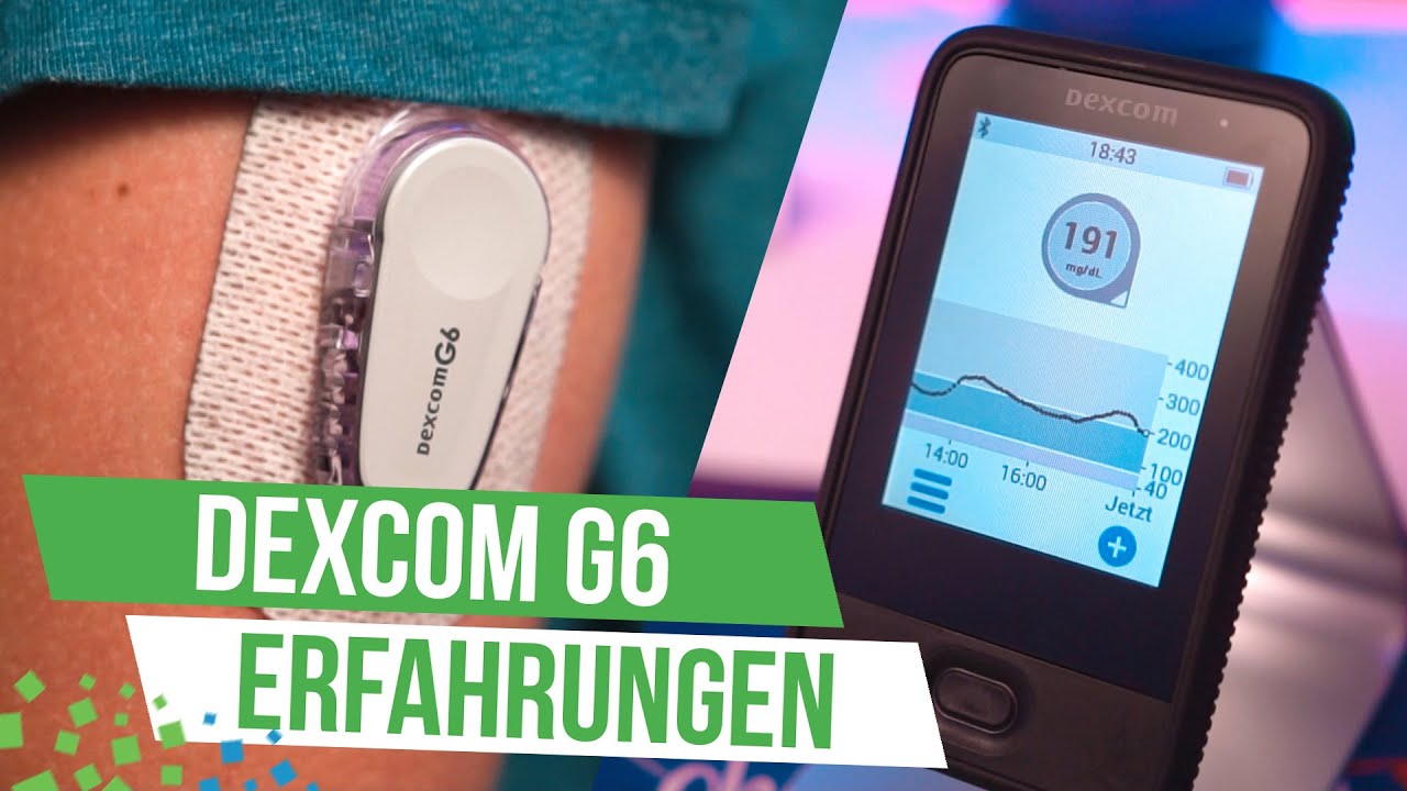 Das beste CGM-System? - Dexcom G6 (Review/Meine Erfahrungen)