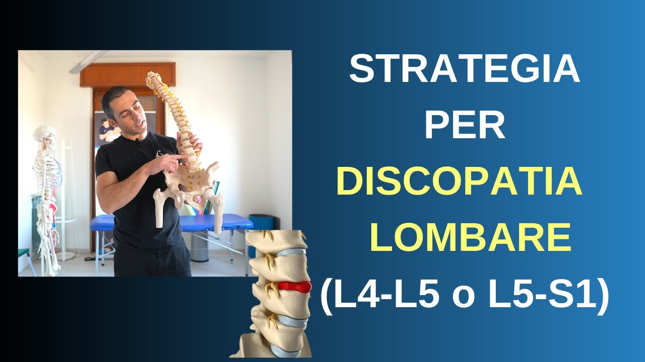 Guida alla DISCOPATIA LOMBARE (L4-L5 o L5-S1): 3 step contro il MAL DI SCHIENA