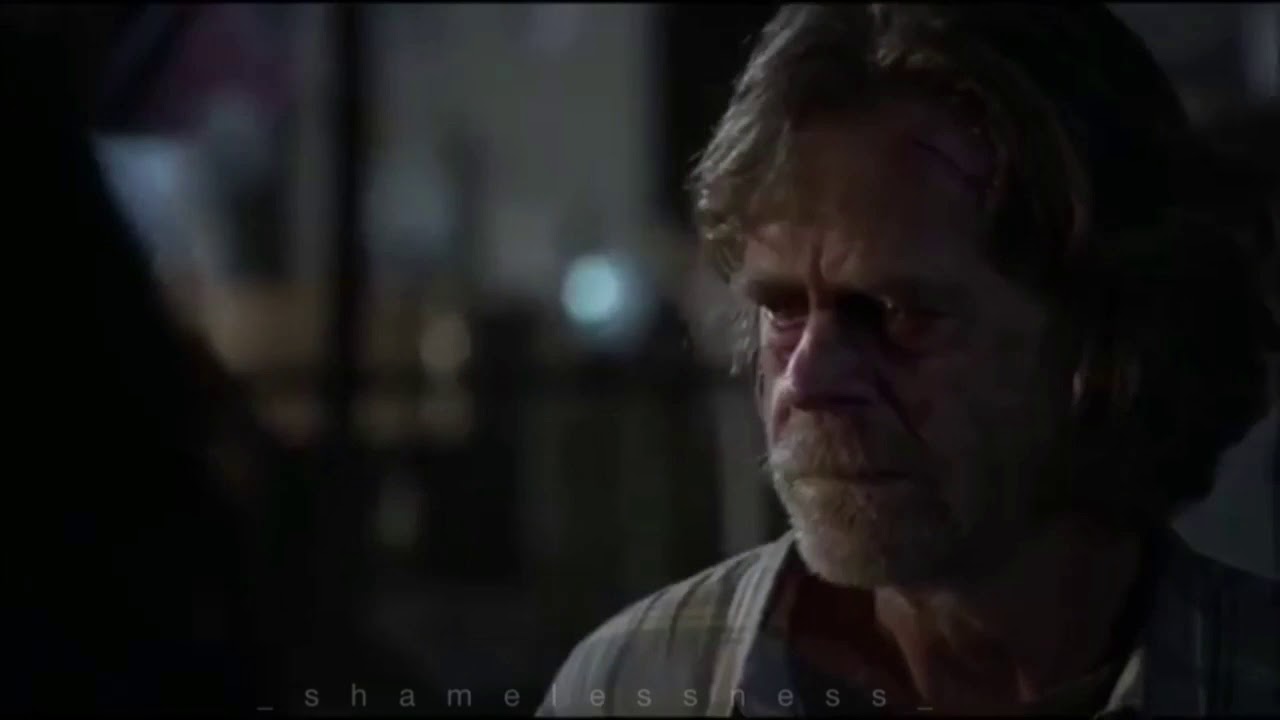 Shameless|| Discoloration