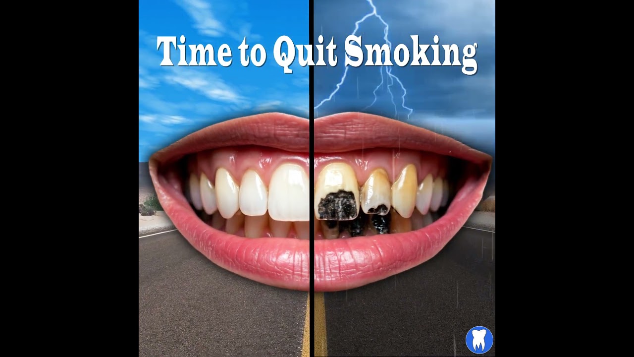 Time to Quit Smoking! 