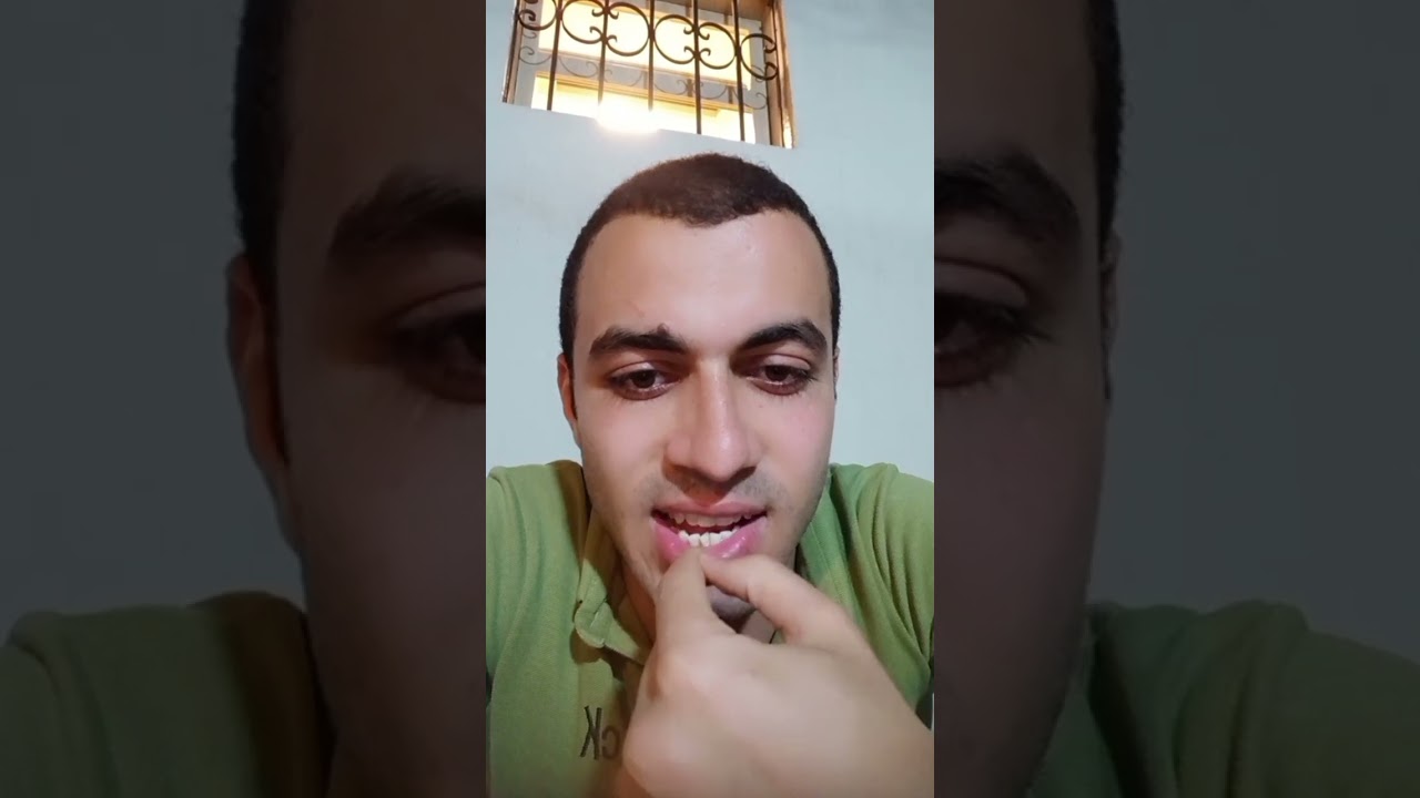 تجربتي مع زراعة الاسنان