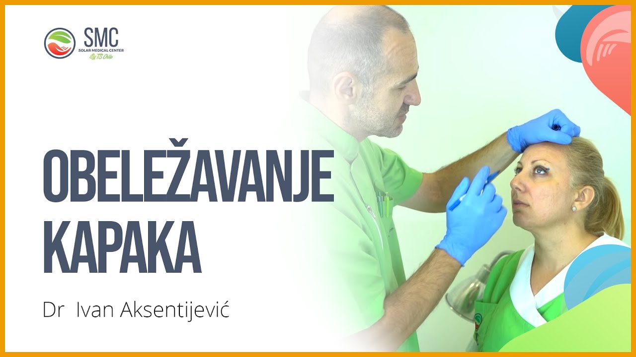 Blefaroplastika - Obeležavanje kapaka