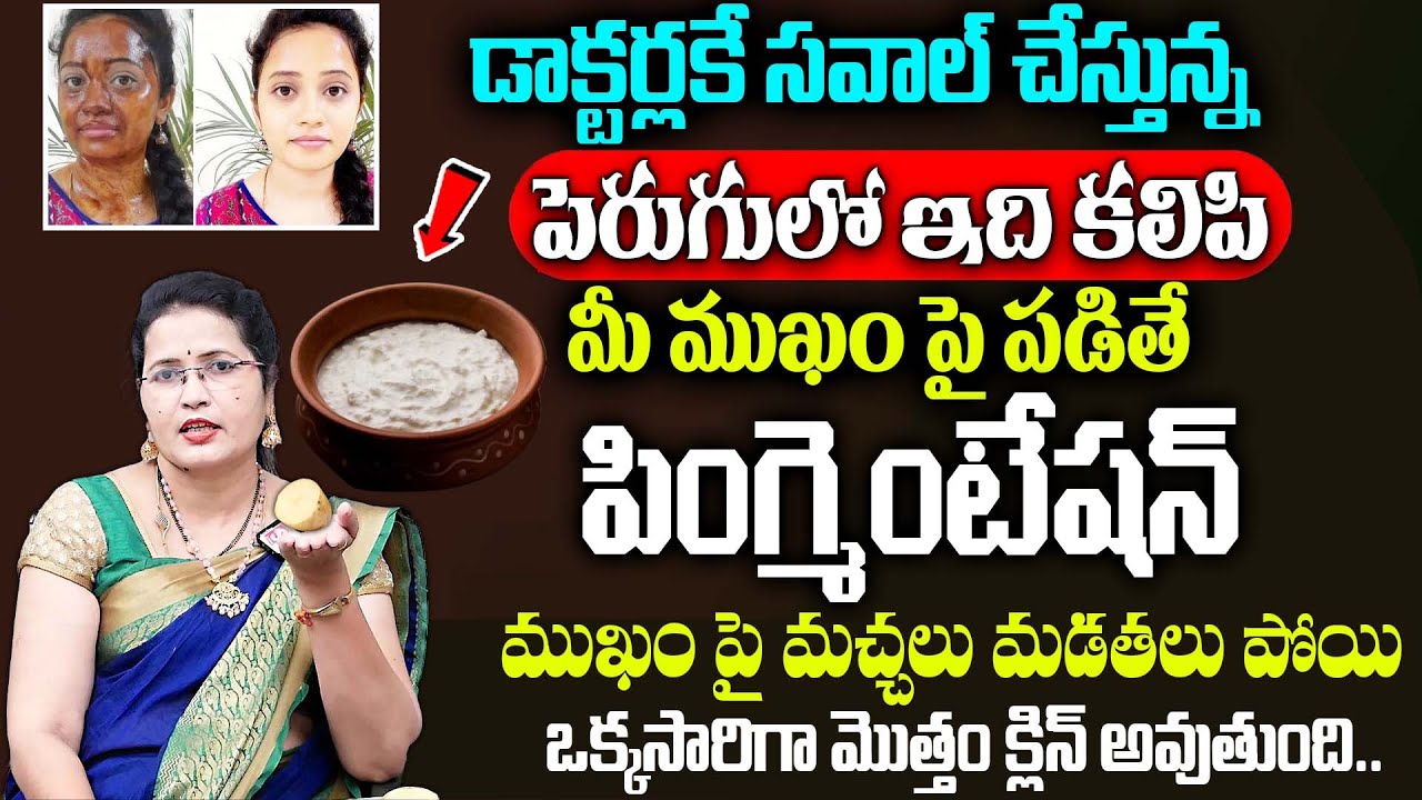 పెరుగులో ఇది కలిపి ముఖం పై పిగ్మెంటేషన్ మచ్చలు మడతలు మొత్తం పోతాయి | Pigmentation | Shobharani Ketha