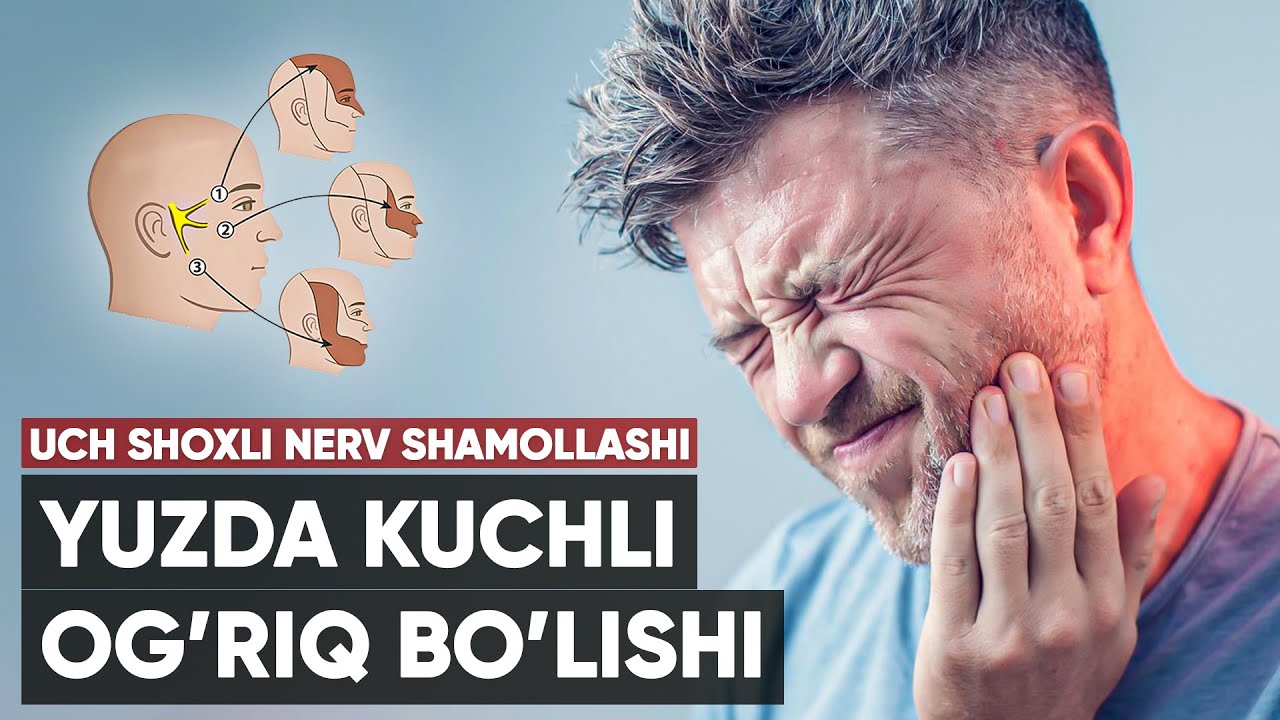 Uch shoxli nerv shamollashi | yuzdagi og'riq sababi!