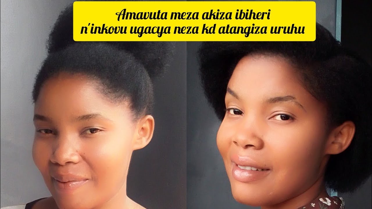 AMAVUTA MEZA AKESHA URUHU KANDI AHENDUTSE //AVURA IBIHERI N'INKOVU UGASA NEZA💕