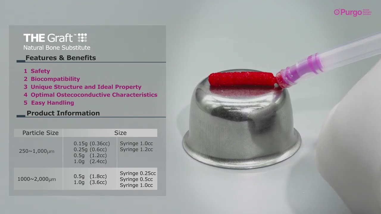 [Hands on] THE Graft™