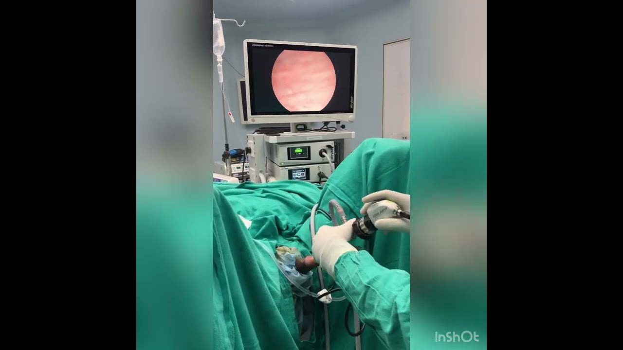Cystoscopy@drprashantUROCLINIC