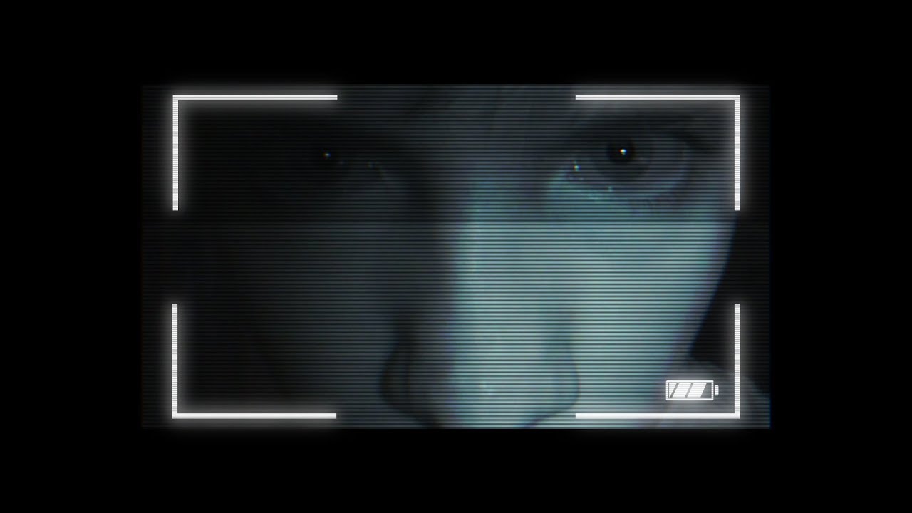 10.ALERTA ft AGC [EYE BAGS]