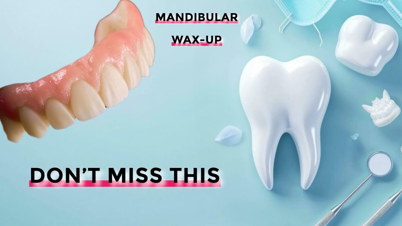 New Mandibular Wax-Up – January 2026