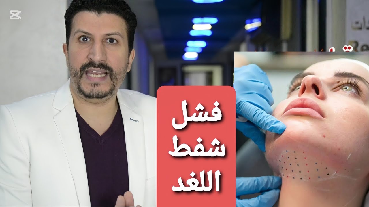 فشل شفط اللغلوغ 💥 نحت اللغد💥 نحت الفكيين 💥 شد الرقبة ☢ إحزروا ما يخفيه دكاترة التجميل عنك 👍 #الرقبة
