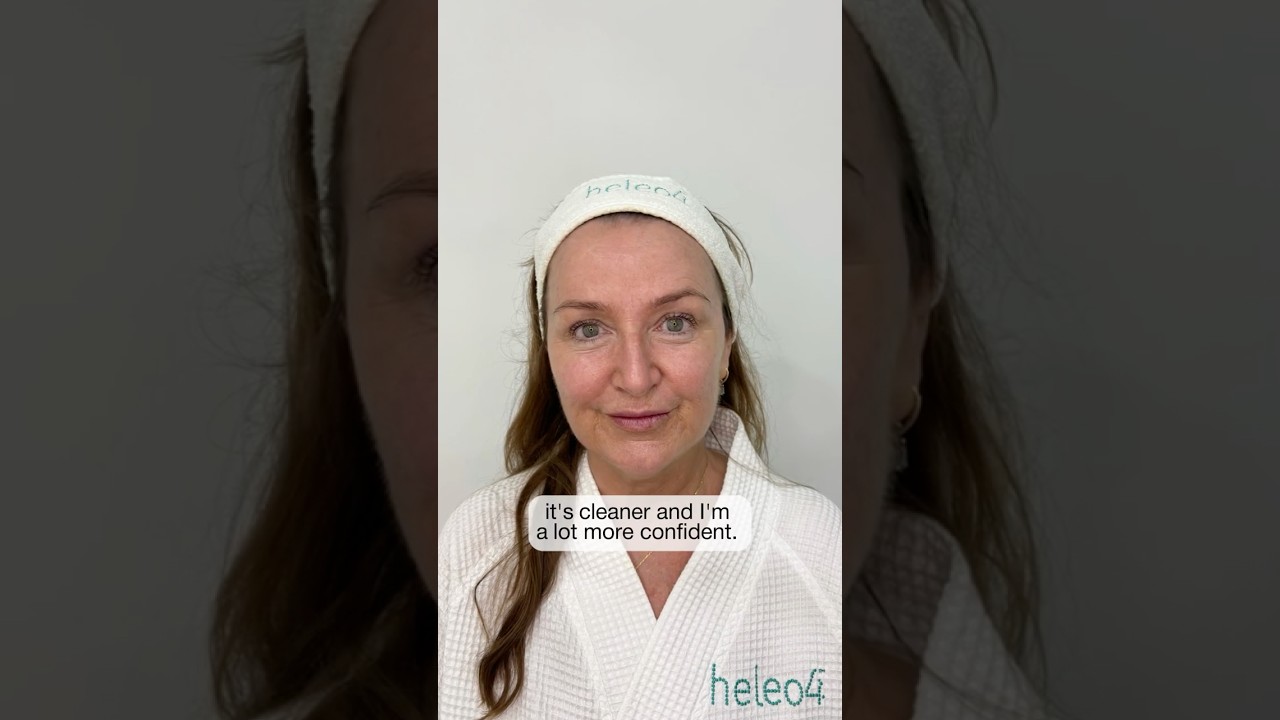 Dermadrop TDA&trade; & Helio4&mdash; Advanced Skin Restoration Without Needles