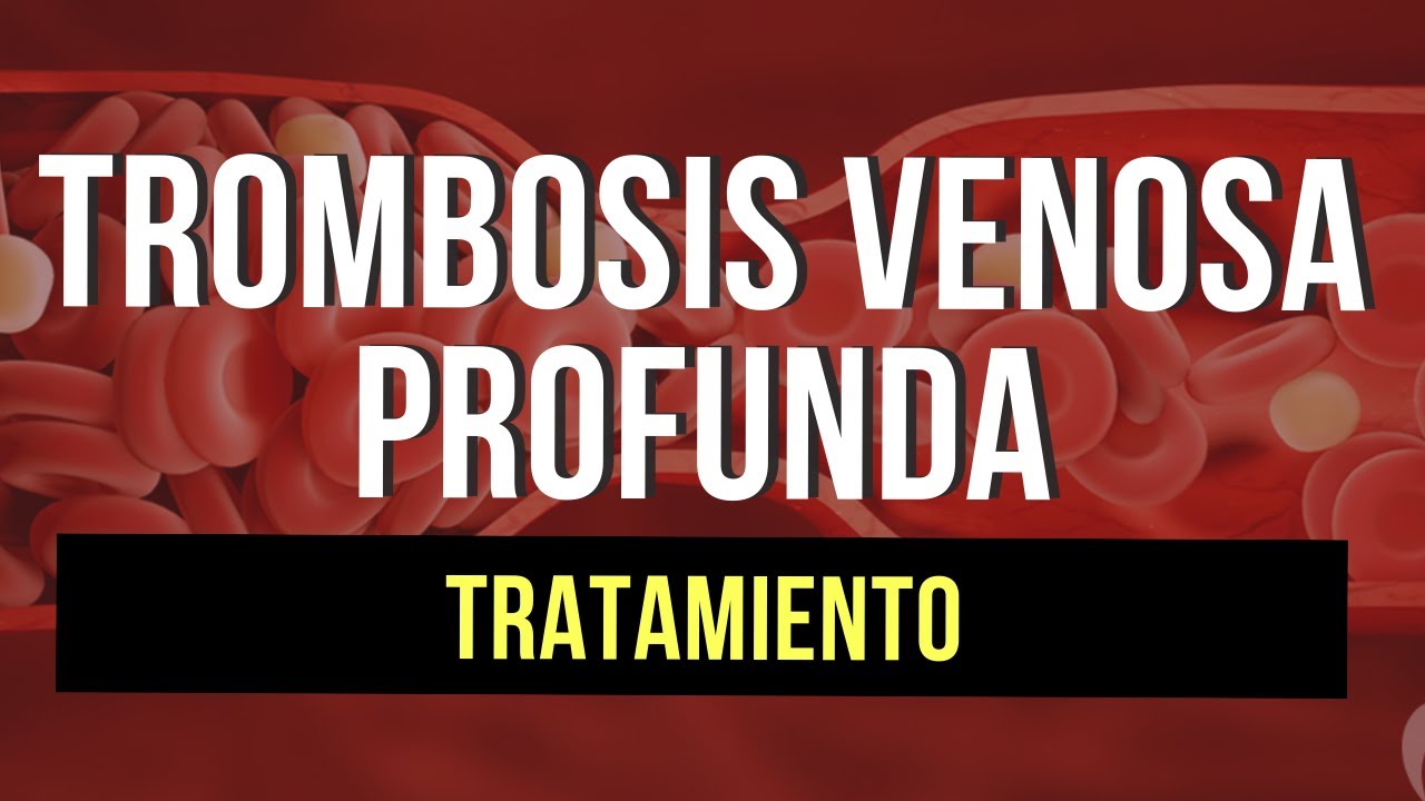 Trombosis Venosa Profunda | Tratamiento (Parte 2)🩸
