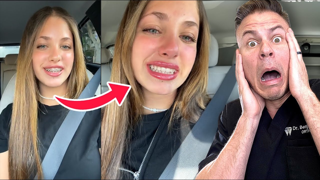 This Is Completely NORMAL When Getting Braces OFF!