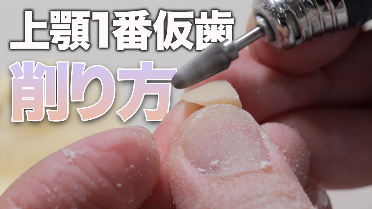 衛生士さんも見て欲しい！上顎1番仮歯の削り方