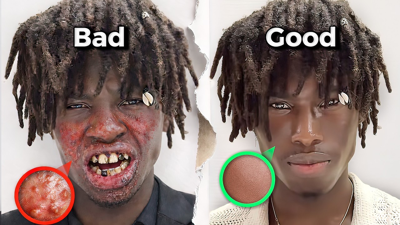 Why 