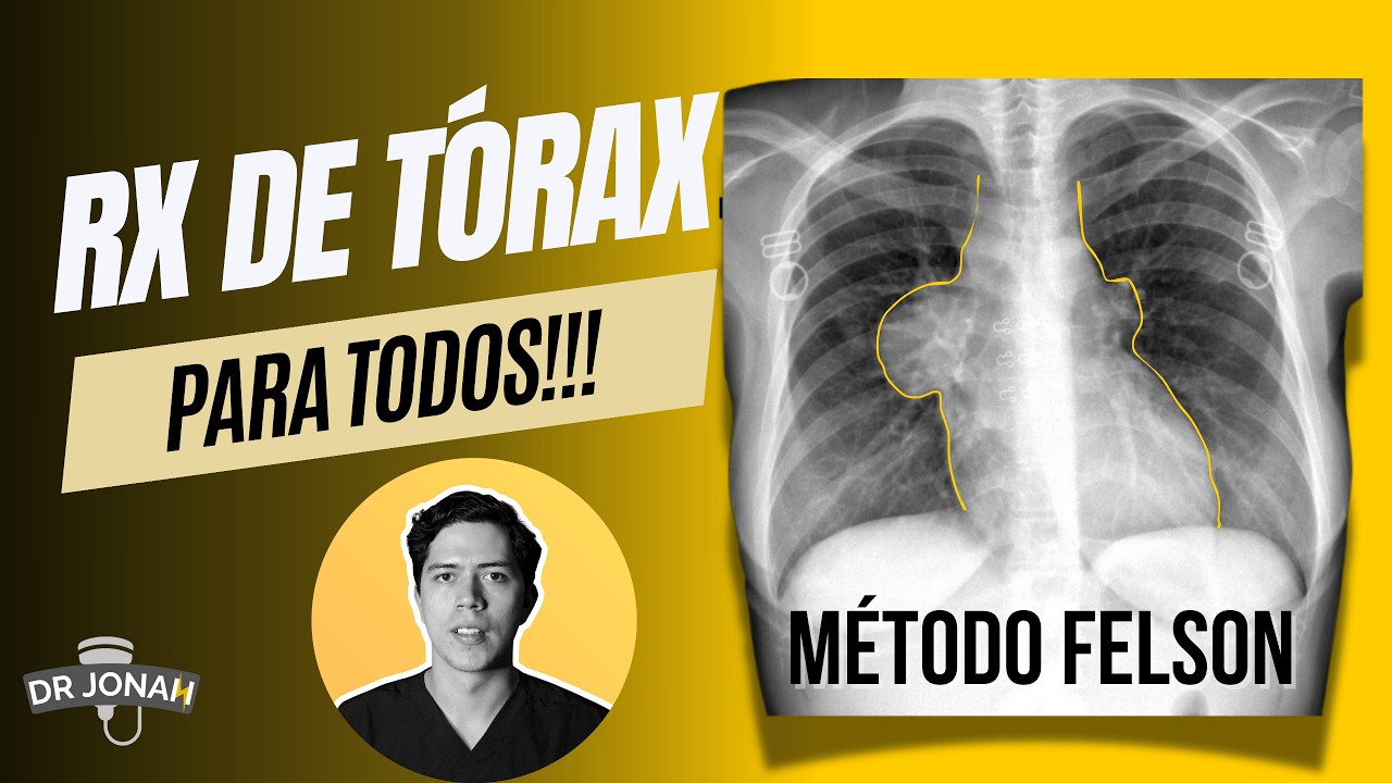 ¡Domina las radiografías de tórax en minutos! | MÉTODO FELSON