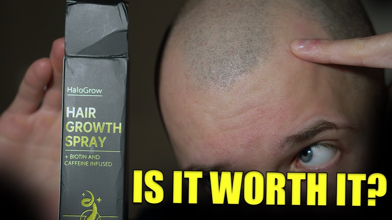Halogrow Hair Spray Honest Review - Can This Product Stop the Hair Loss?