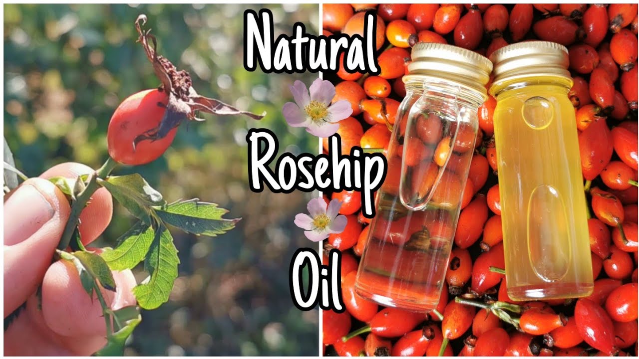 How To Make Rosehip Oil - Easily Step By Step 🌹