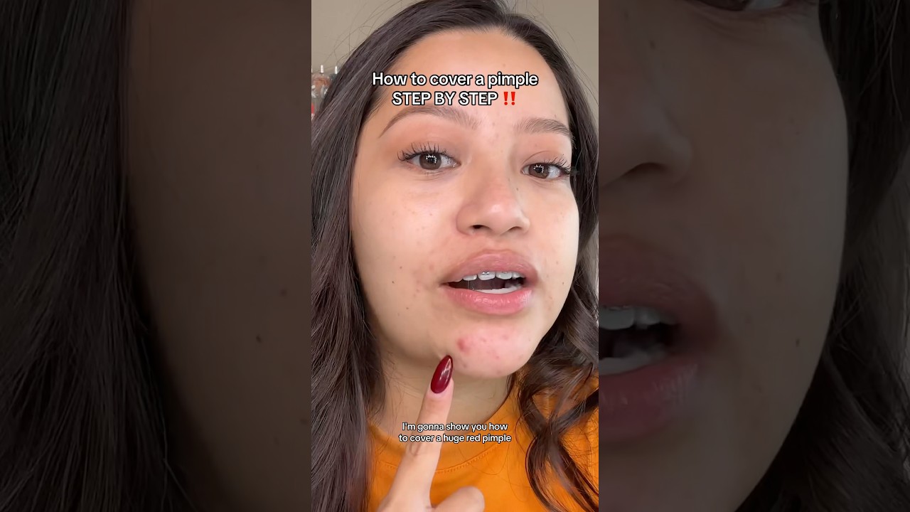 How to cover a huge red pimple STEP BY STEP ‼️