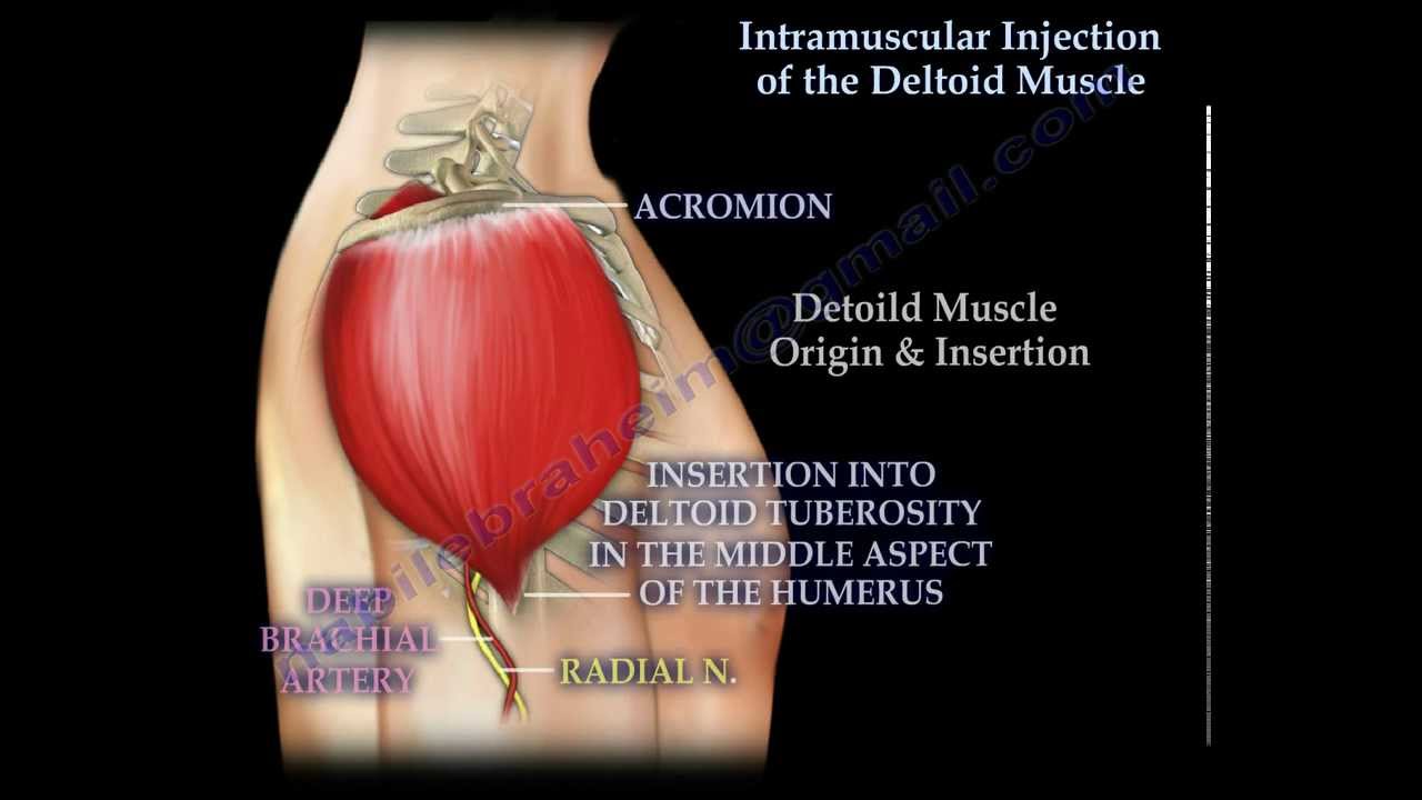 Intramuscular injection of the deltoid muscle  - Everything You Need To Know - Dr. Nabil Ebraheim
