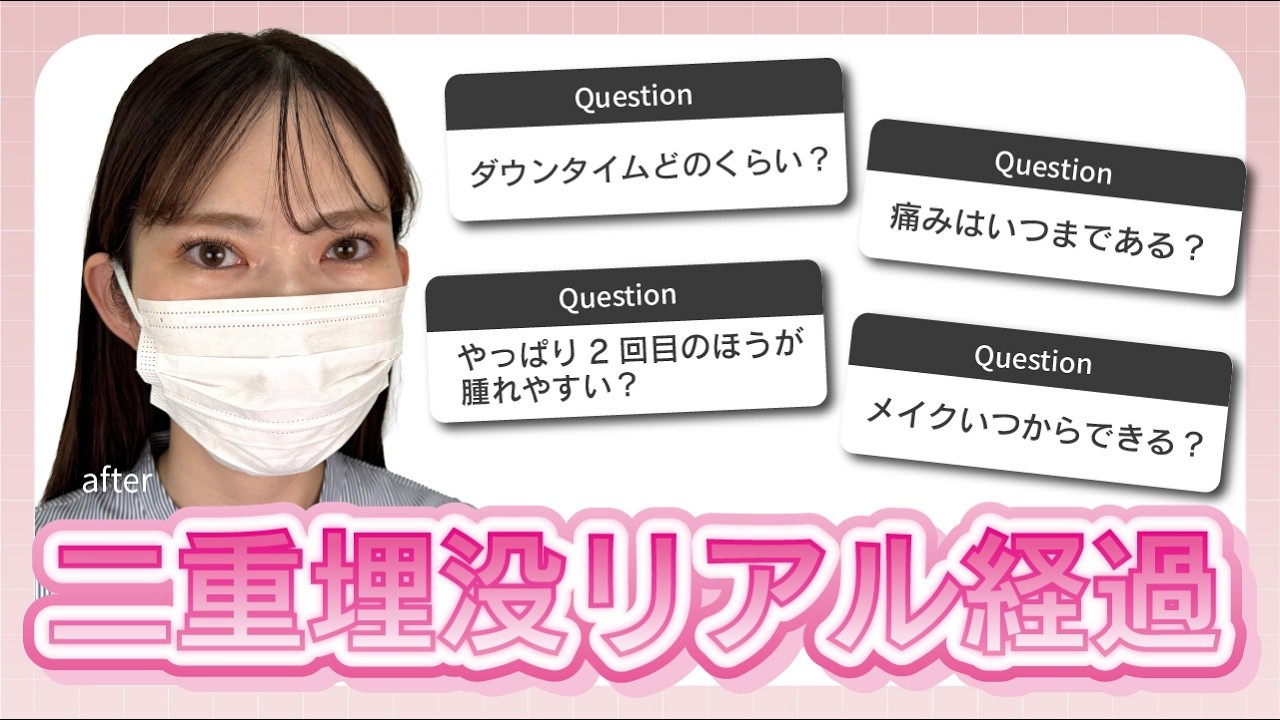【衝撃】1回目と全然違う⁉️2回目埋没のリアルなダウンタイムを全公開。