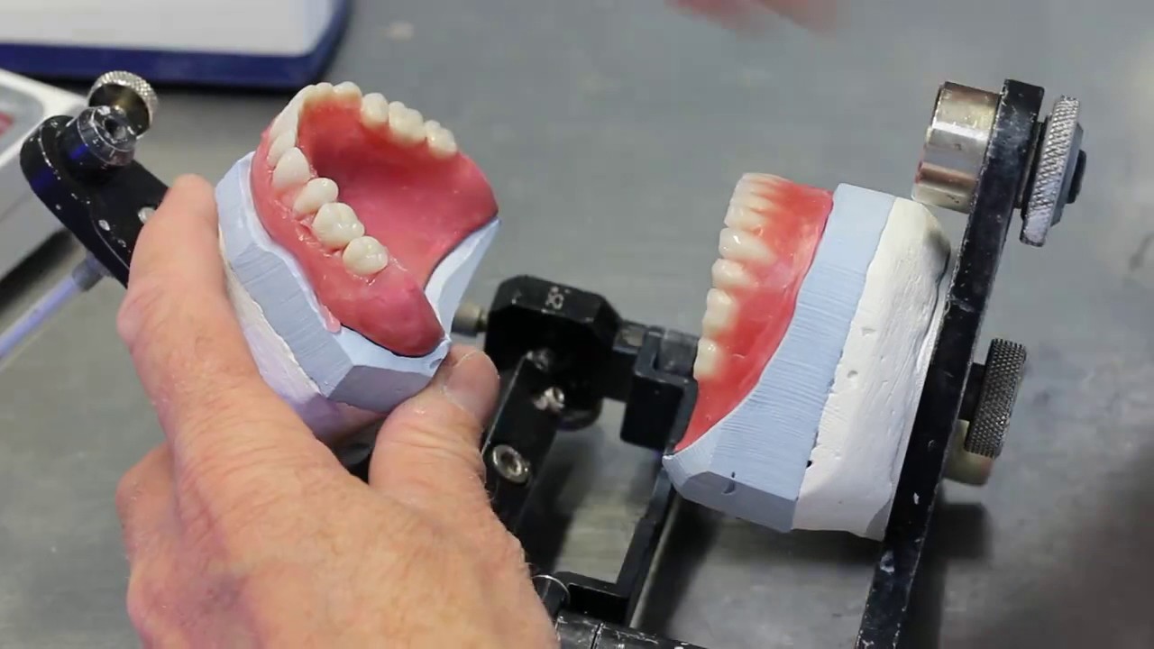 Opstellen van een kunstgebit