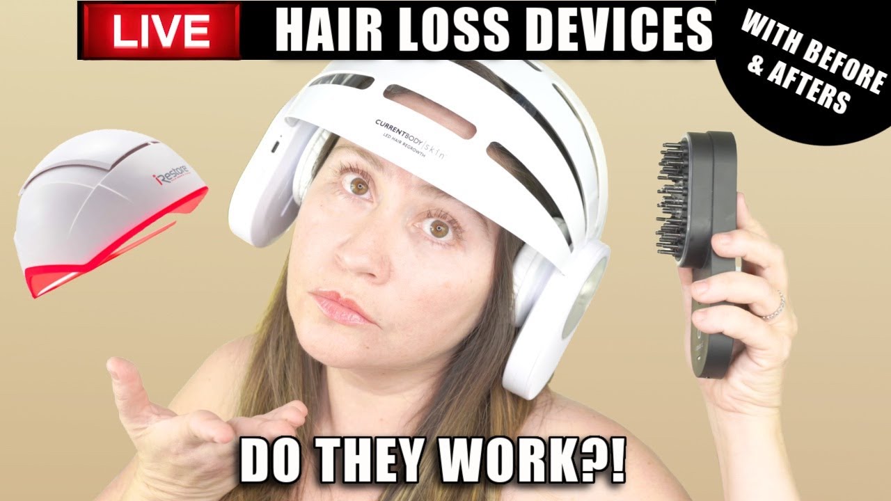 HAIR LOSS DEVICES | DO THEY WORK? | with before & afters