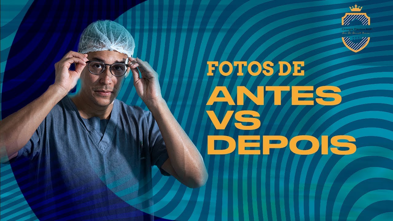 Fotos de antes e depois