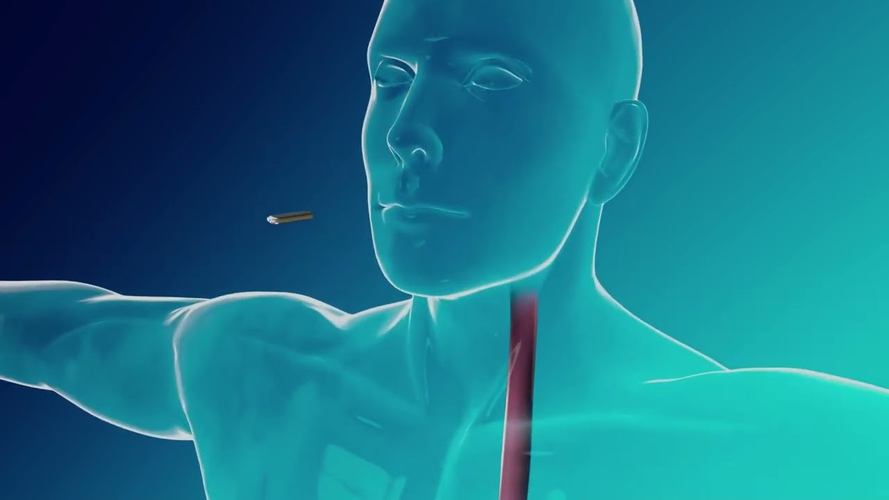 Innovative MAGDI Procedure for Weight Loss & Type 2 Diabetes