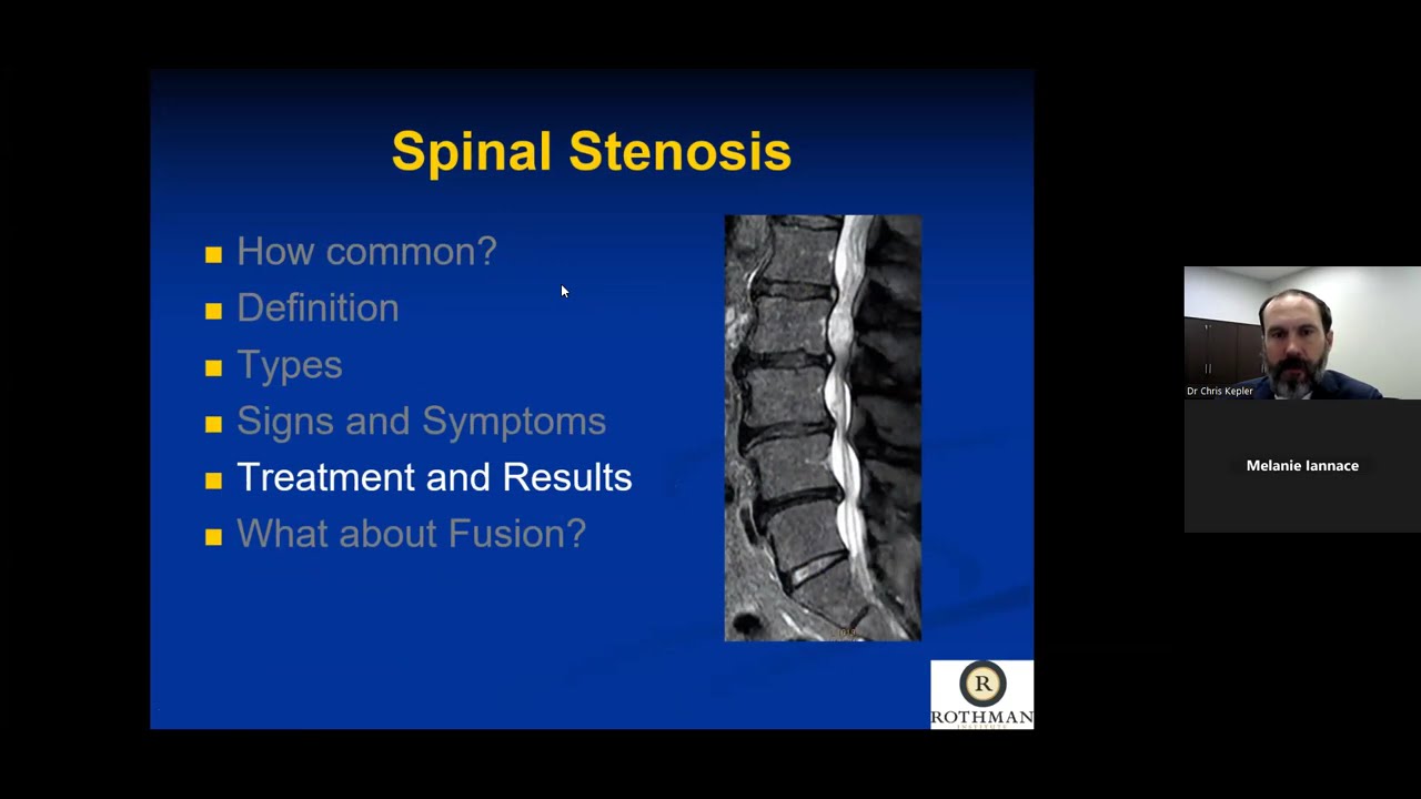Lumbar Spinal Stenosis: Diagnosis and Treatment Options  – A Lecture from Dr. Christopher Kepler