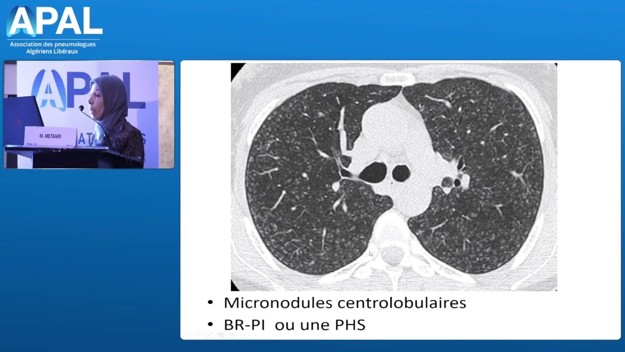 Prise en charge des PID par la Pneumologue Liberal : Pr M.METAHRI , APAL ORAN MAI 2024