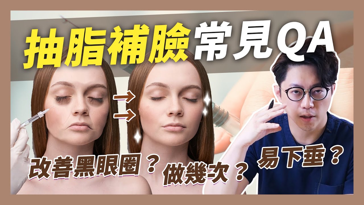 抽脂補臉常見QA 脂肪位移？補太多怎辦？黑眼圈能治療嗎｜周杰醫師