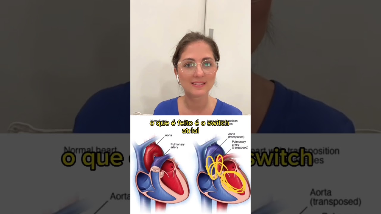 Descomplicando a Transposição das grandes artérias
