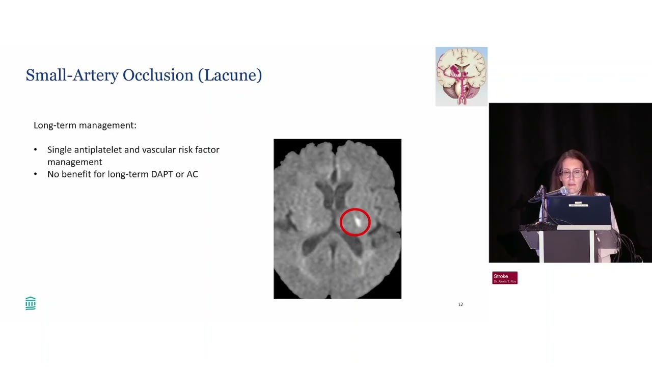 116  Updates in Stroke Diagnosis and Management  HarvardUpdate Medstudylab.com