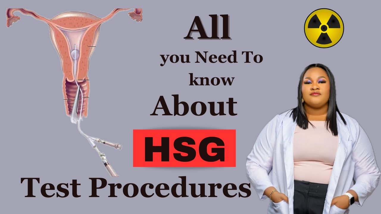 Watch This Video!! Before Getting a HSG Test Done in Nigeria | Hsg test and Increased fertility