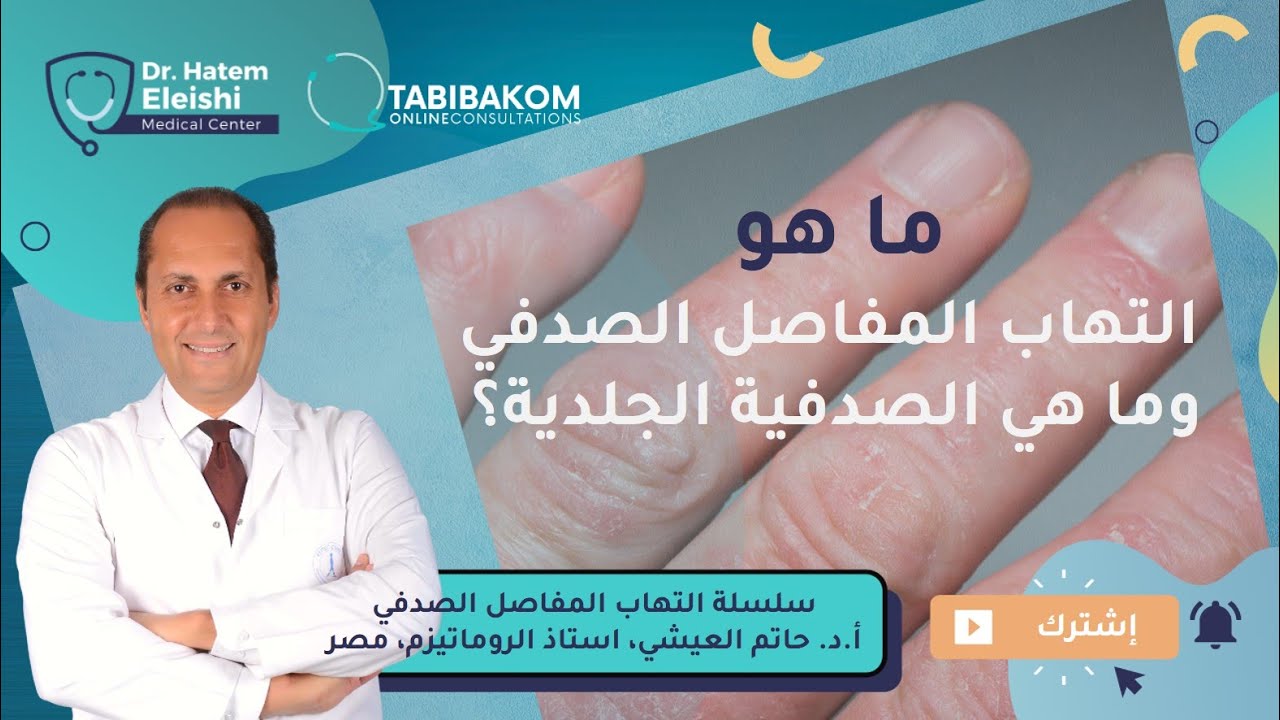 مش كل التهاب مفاصل روماتويد | ما هو التهاب المفاصل الصدفي؟