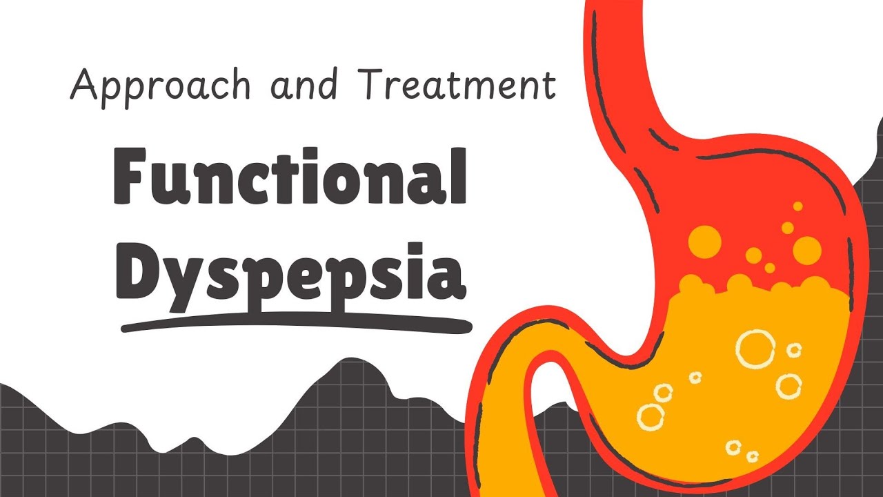 Approach and Tratment of functional dydpepsia