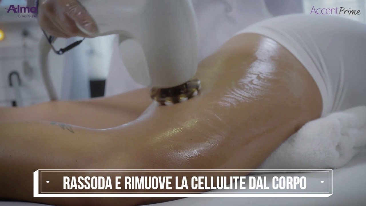 Come funziona Accent Prime? ULTRASUONI + RADIOFREQUENZA