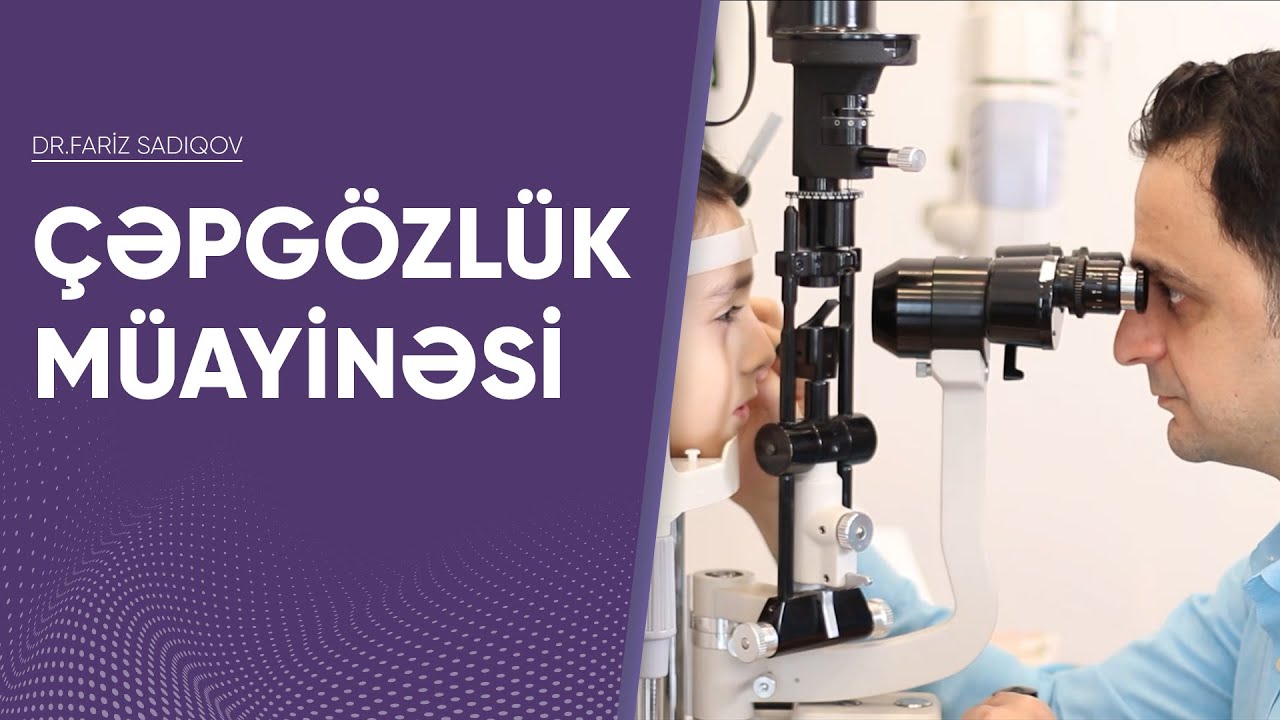 Çəpgözlüyün müayinəsi✅