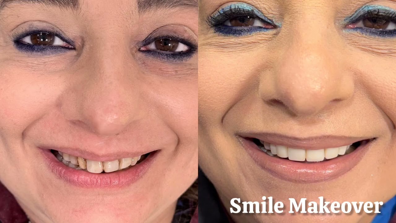 Top Dental Clinic in South Delhi, VIN SMILES ADVANCED DENTISTRY GK2